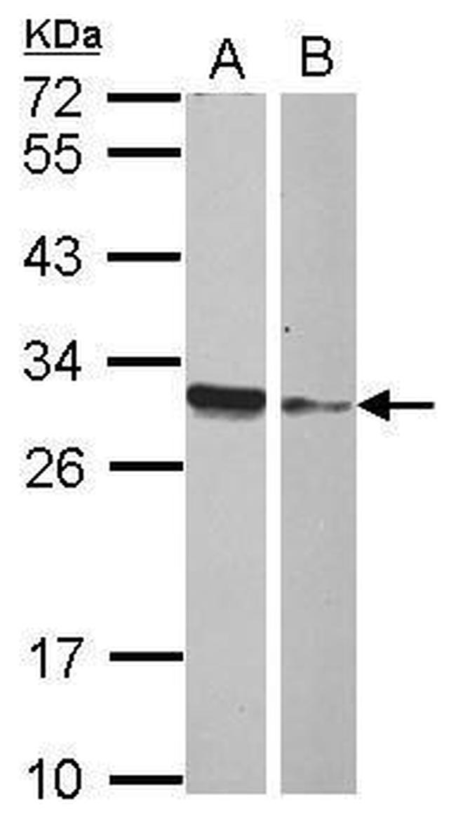 HMGB4 Antibody in Western Blot (WB)