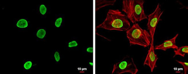 H4ac pan-acetyl (K5,K8,K12,K16) Antibody in Immunocytochemistry (ICC/IF)