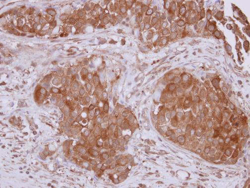 STUB1 Antibody in Immunohistochemistry (Paraffin) (IHC (P))