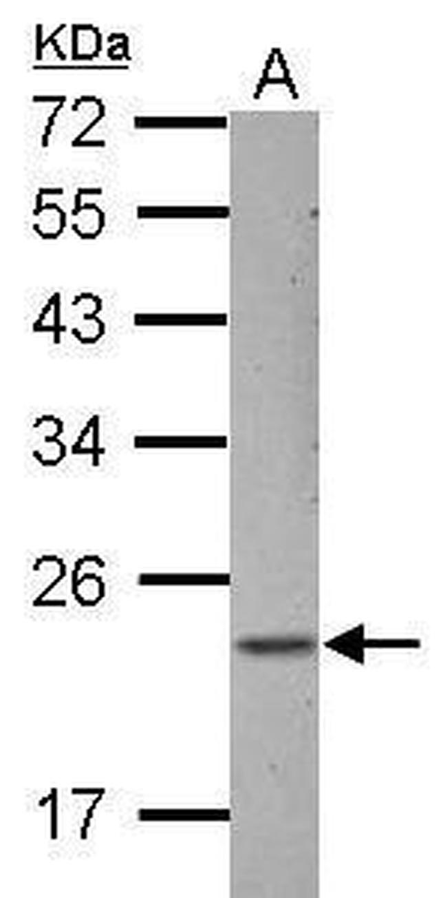 ZNF22 Antibody in Western Blot (WB)