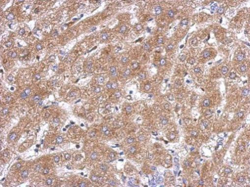 ACOT12 Antibody in Immunohistochemistry (Paraffin) (IHC (P))