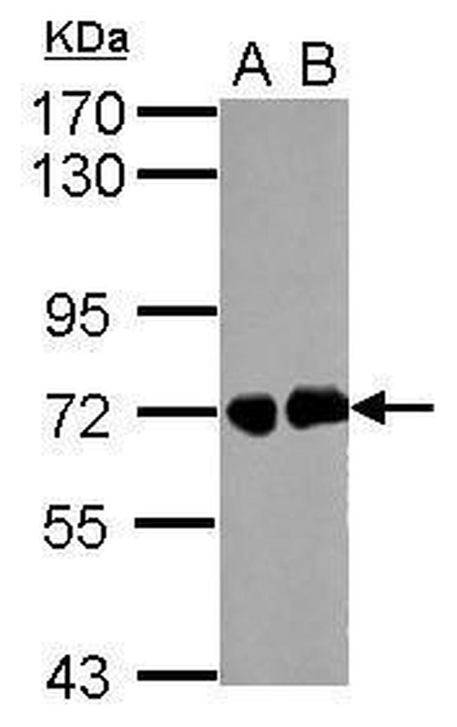 Helicobacter Pylori Urease B Polyclonal Antibody (PA5-32167)