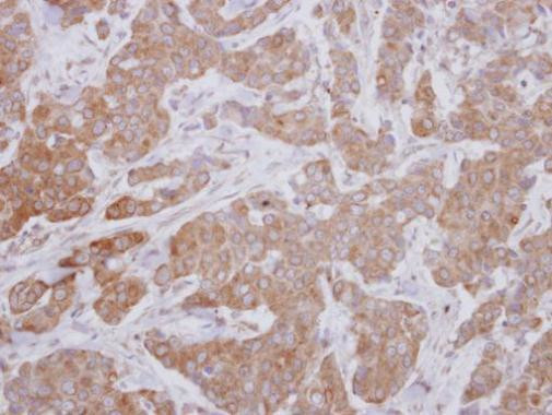 ZPK Antibody in Immunohistochemistry (Paraffin) (IHC (P))