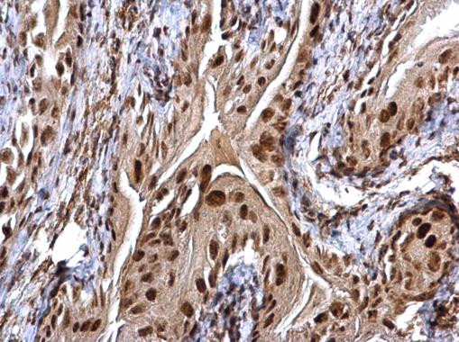 CHD4 Antibody in Immunohistochemistry (Paraffin) (IHC (P))