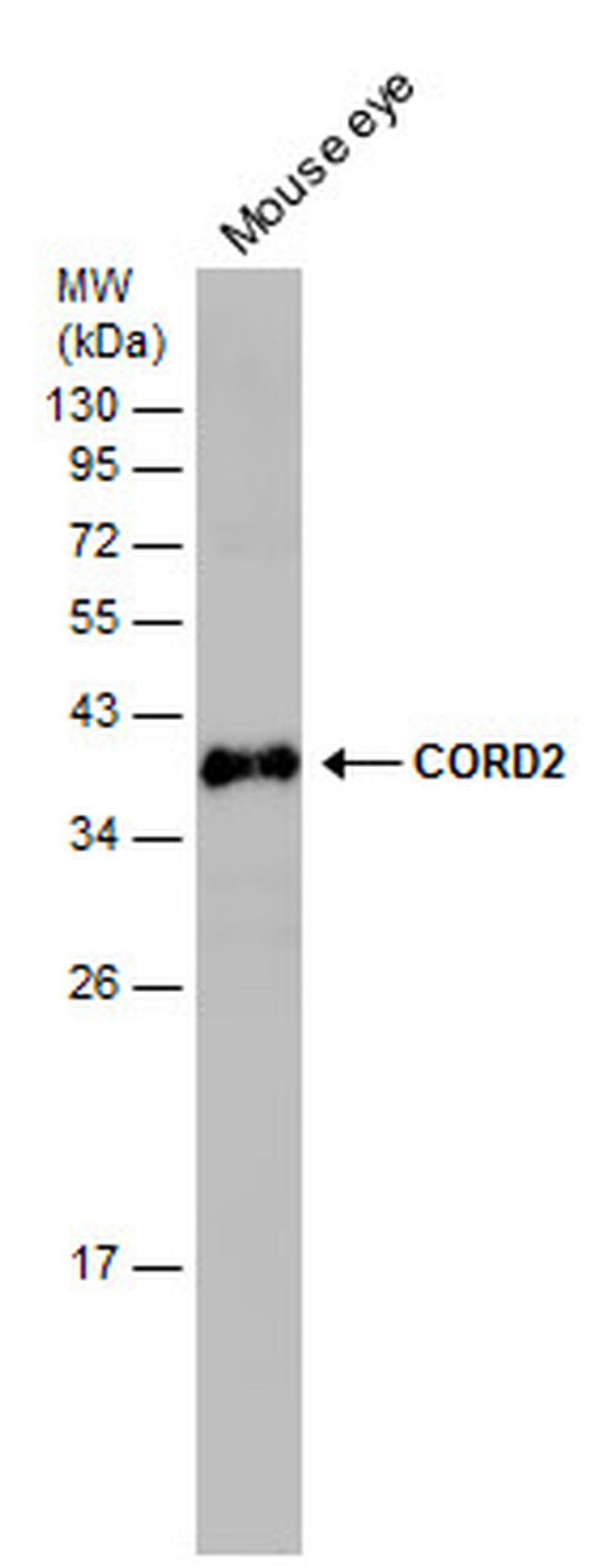 CRX Antibody in Western Blot (WB)