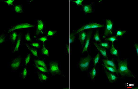 GLI1 Antibody in Immunocytochemistry (ICC/IF)