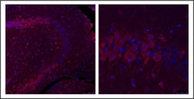 GLI1 Antibody in Immunohistochemistry (Paraffin) (IHC (P))