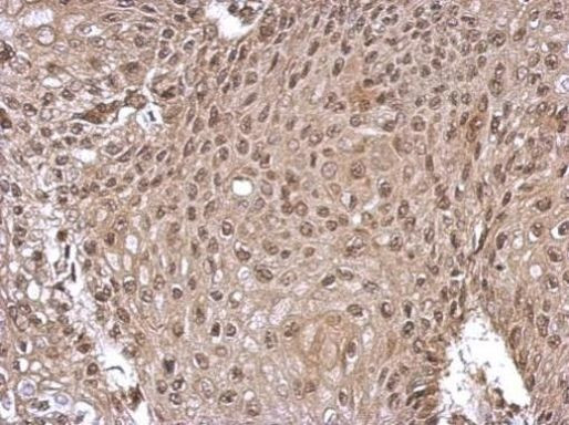 GLI1 Antibody in Immunohistochemistry (Paraffin) (IHC (P))