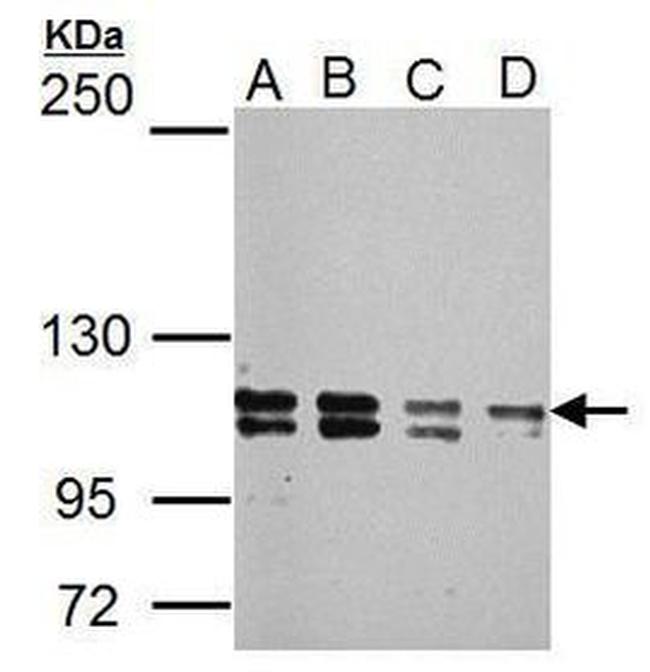 GLI1 Antibody in Western Blot (WB)