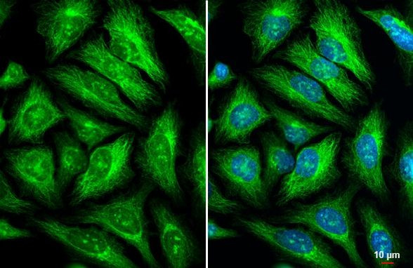 GEF-H1 Antibody in Immunocytochemistry (ICC/IF)