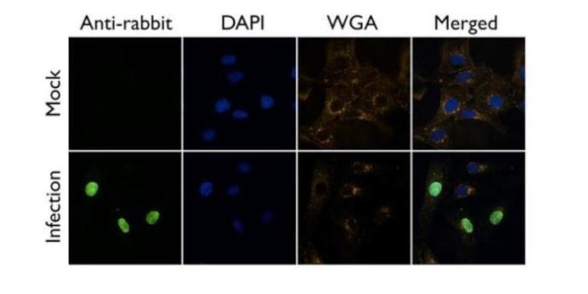 Influenza A NP Antibody in Immunocytochemistry (ICC/IF)