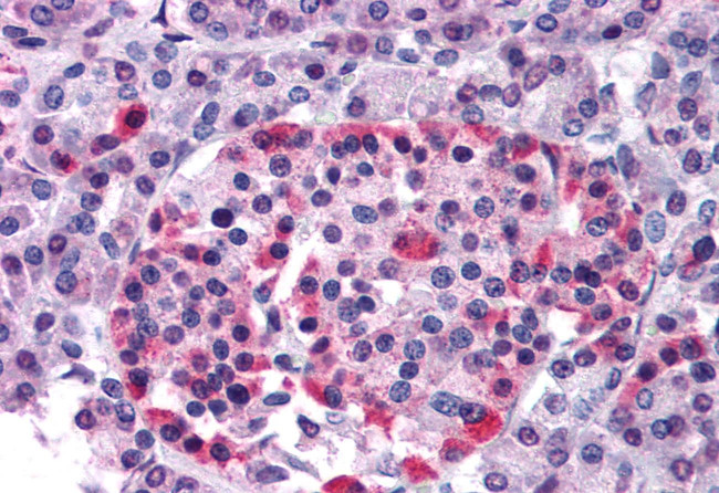 GPR81 Antibody in Immunohistochemistry (Paraffin) (IHC (P))