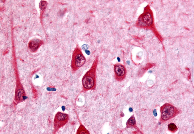 MTNR1B Antibody in Immunohistochemistry (Paraffin) (IHC (P))