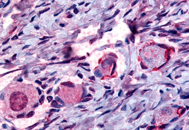 NR4A1 Antibody in Immunohistochemistry (Paraffin) (IHC (P))