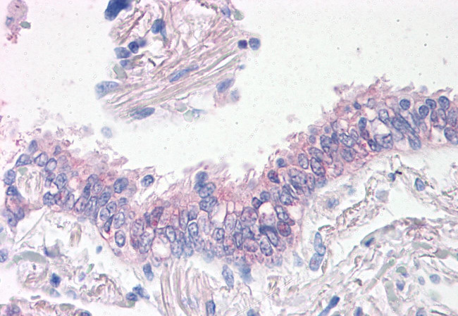 Prominin 2 Antibody in Immunohistochemistry (Paraffin) (IHC (P))