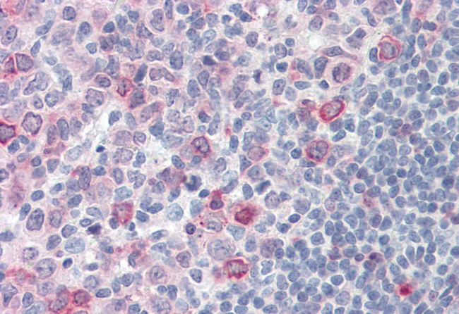 SUSD2 Antibody in Immunohistochemistry (Paraffin) (IHC (P))