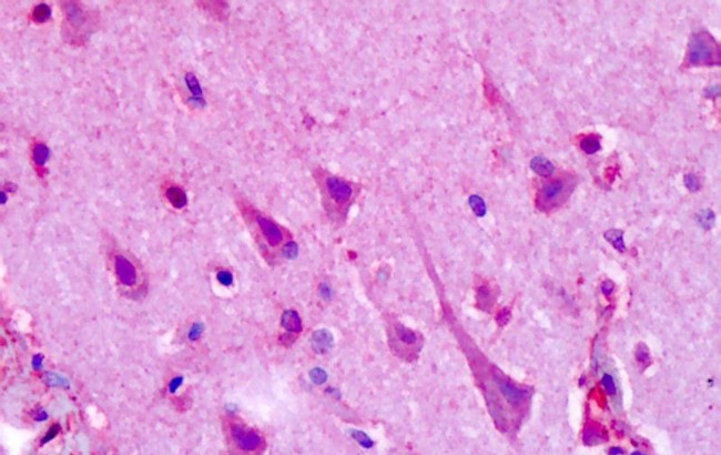 HTR1F Antibody in Immunohistochemistry (Paraffin) (IHC (P))