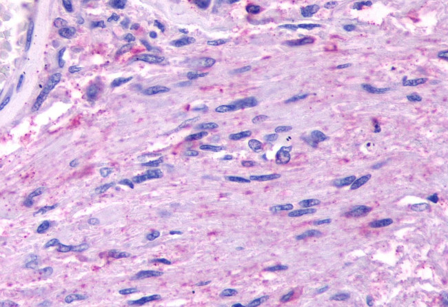 HTR5A Antibody in Immunohistochemistry (Paraffin) (IHC (P))