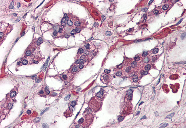 PACAP Receptor Antibody in Immunohistochemistry (Paraffin) (IHC (P))