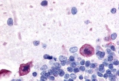 ADORA1 Antibody in Immunohistochemistry (Paraffin) (IHC (P))