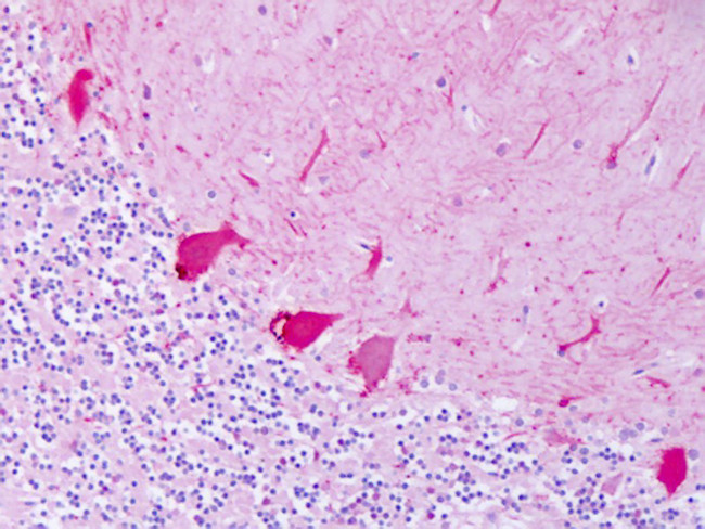 beta-2 Adrenergic Receptor Antibody in Immunohistochemistry (Paraffin) (IHC (P))