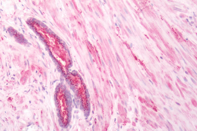 beta-3 Adrenergic Receptor Antibody in Immunohistochemistry (Paraffin) (IHC (P))