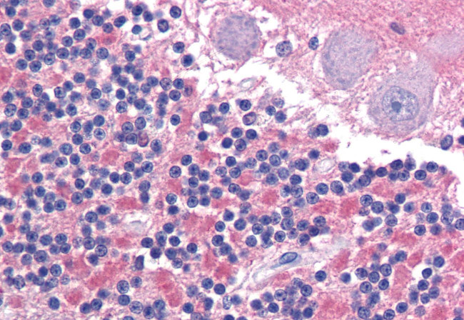 CADM2 Antibody in Immunohistochemistry (Paraffin) (IHC (P))