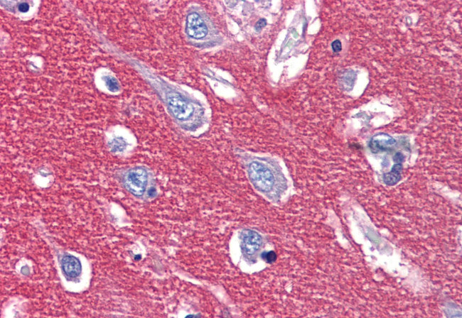 CADM2 Antibody in Immunohistochemistry (Paraffin) (IHC (P))