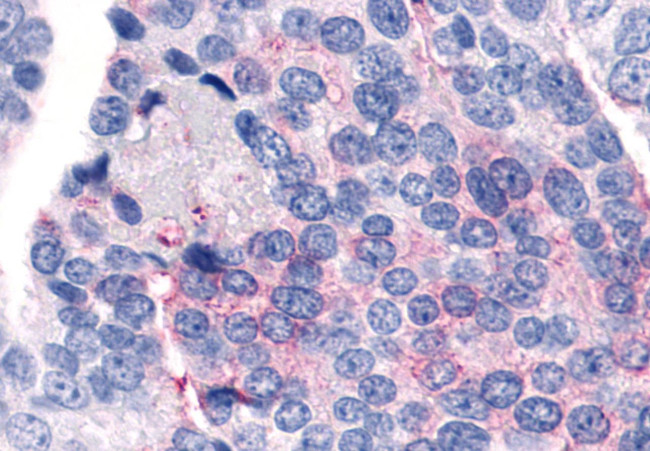 PAR2 Antibody in Immunohistochemistry (Paraffin) (IHC (P))