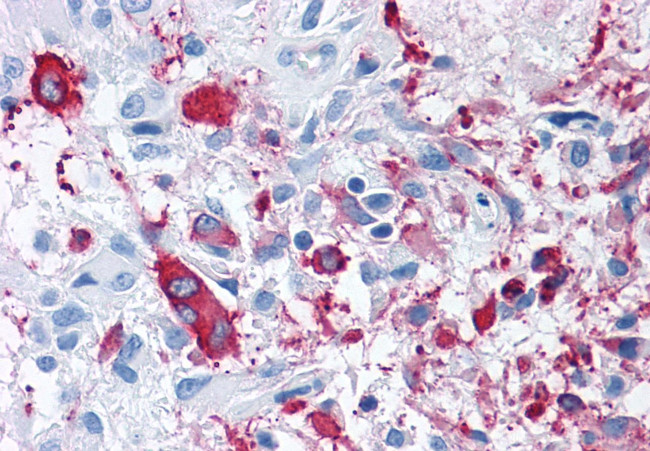 FZD3 Antibody in Immunohistochemistry (Paraffin) (IHC (P))