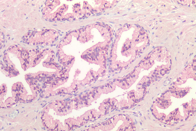 FZD7 Antibody in Immunohistochemistry (Paraffin) (IHC (P))