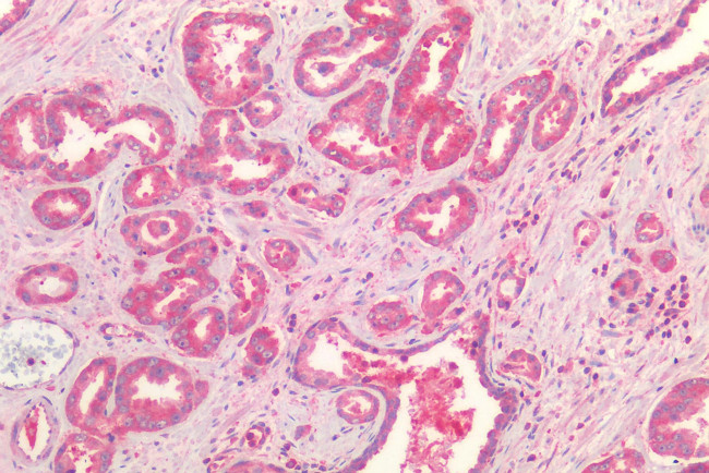 FZD7 Antibody in Immunohistochemistry (Paraffin) (IHC (P))