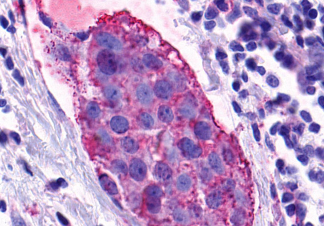 GPR139 Antibody in Immunohistochemistry (Paraffin) (IHC (P))