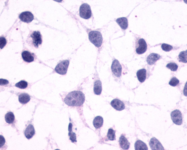 CRTH2 Antibody in Immunocytochemistry (ICC/IF)