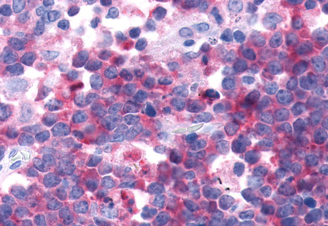 CRTH2 Antibody in Immunohistochemistry (Paraffin) (IHC (P))