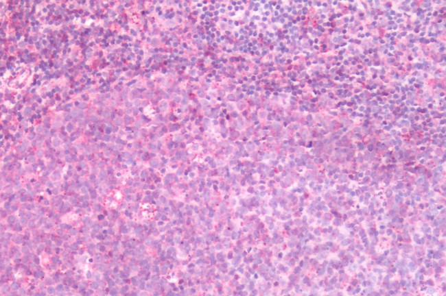 CRTH2 Antibody in Immunohistochemistry (Paraffin) (IHC (P))