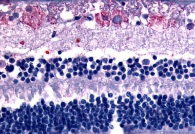 GPR75 Antibody in Immunohistochemistry (Paraffin) (IHC (P))