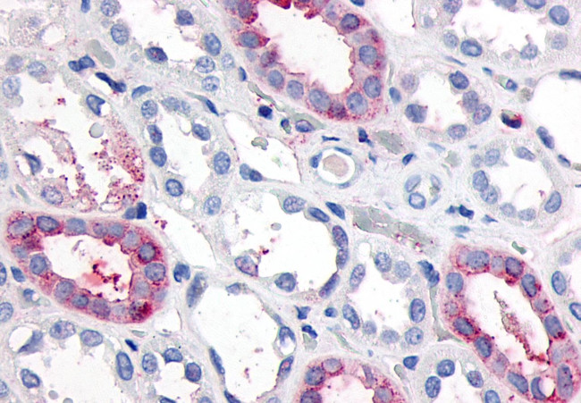 GPR89A Antibody in Immunohistochemistry (Paraffin) (IHC (P))