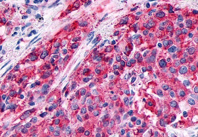 GPR89A Antibody in Immunohistochemistry (Paraffin) (IHC (P))