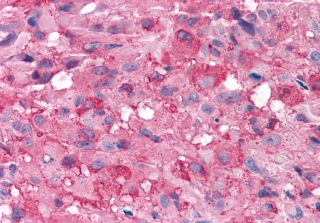 mGluR7 Antibody in Immunohistochemistry (Paraffin) (IHC (P))