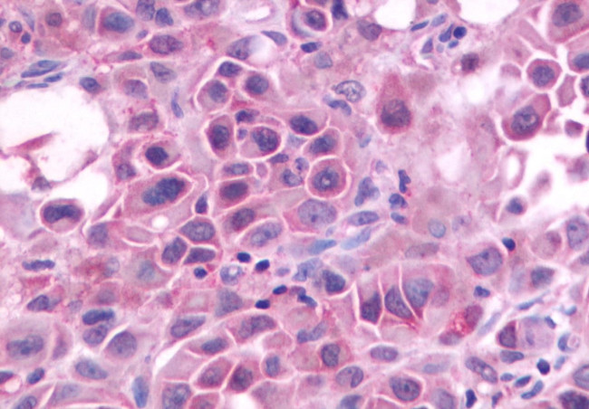 GRPR Antibody in Immunohistochemistry (Paraffin) (IHC (P))