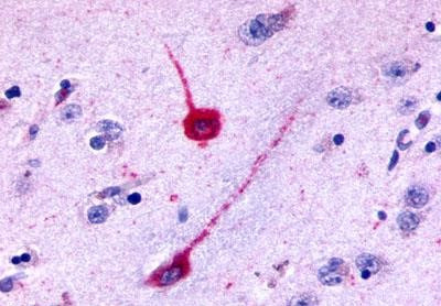 HTR6 Antibody in Immunohistochemistry (Paraffin) (IHC (P))