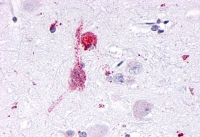 KISS1R Antibody in Immunohistochemistry (Paraffin) (IHC (P))