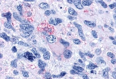 OXGR1 Antibody in Immunohistochemistry (Paraffin) (IHC (P))