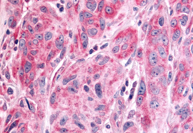 PTPRE Antibody in Immunohistochemistry (Paraffin) (IHC (P))