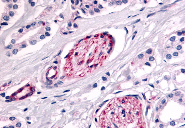 PTPRE Antibody in Immunohistochemistry (Paraffin) (IHC (P))