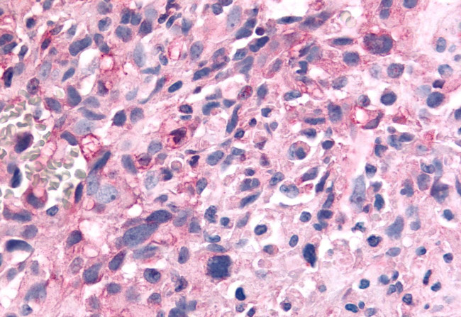 PTPRE Antibody in Immunohistochemistry (Paraffin) (IHC (P))