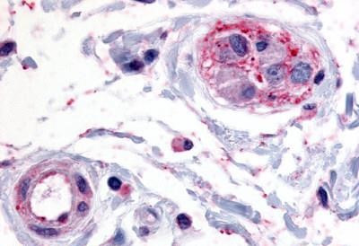 PTPRE Antibody in Immunohistochemistry (Paraffin) (IHC (P))