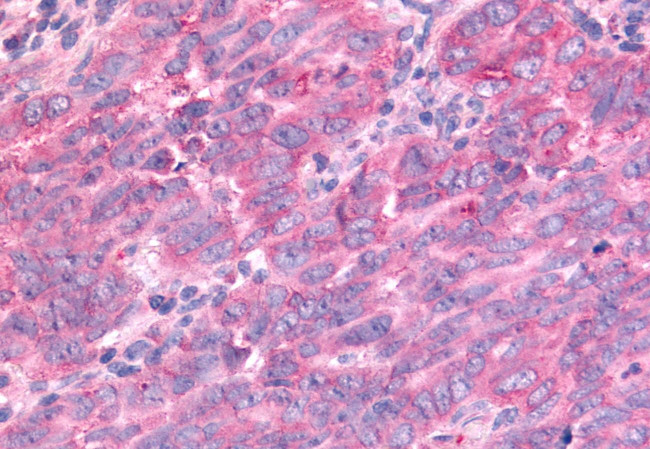 PTPRE Antibody in Immunohistochemistry (Paraffin) (IHC (P))