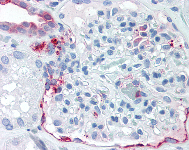 ZIP14 Antibody in Immunohistochemistry (Paraffin) (IHC (P))